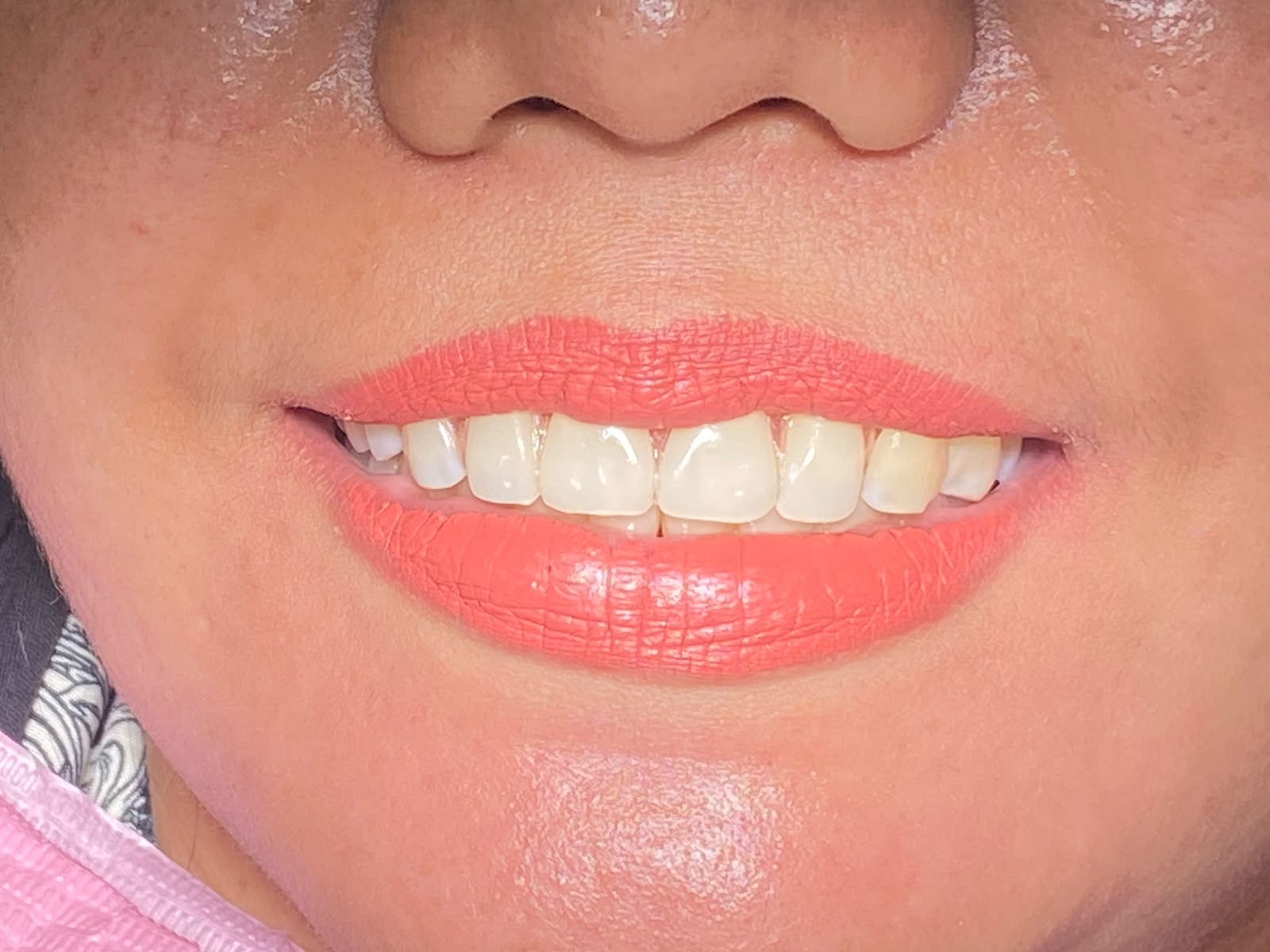 Gigi Palsu di Sky Dental Care Jambi